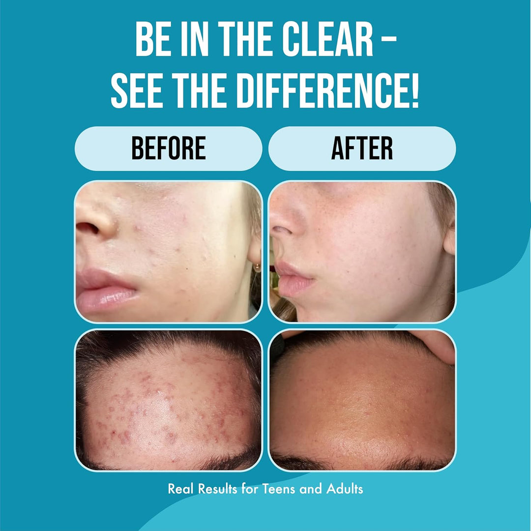 Papaya Gentle Face Cleanser - *Improved Clear Formula!*