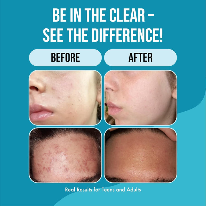 Papaya Gentle Face Cleanser - *Improved Clear Formula!*